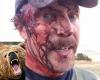 Atacado por un oso Grizzly en Montana y vive para contarlo... en Facebook